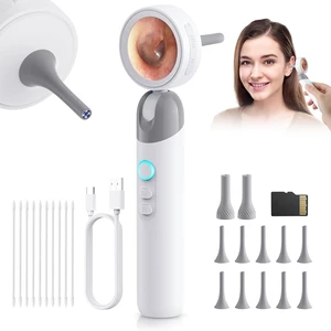 Digital Otoscope Ear Camera for Family, 1.38-Inch Screen, No App Needed | 32GB TF Card, Ear Camera with 4 LED Lights, 3X Magnification, Photo/Video, Telemedicine Ready, 90° Rotating Head Digital Otoscope Ear Camera for Family, 1.38-Inch Screen, No App Needed | 32GB TF Card, Ear Camera with 4 LED Lights, 3X Magnification, Photo/Video, Telemedicine Ready, 90° Rotating Head
