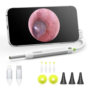 Digital Otoscope, Video Ear Scope Camera Compatible with iPhone/Android | 3.9mm Otoscope with Light, Plug & Play, Photo & Video, Split-screen mode, Earwax Removal Kit for Home Cleaning Checking Digital Otoscope, Video Ear Scope Camera Compatible with iPhone/Android | 3.9mm Otoscope with Light, Plug & Play, Photo & Video, Split-screen mode, Earwax Removal Kit for Home Cleaning Checking
