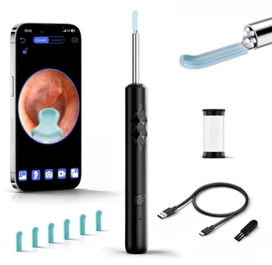 Ear Wax Removal Kit with 1296P HD Camera and 6 LED Earwax Cleaner Black Ear Wax Removal Kit with 1296P HD Camera and 6 LED Earwax Cleaner Black