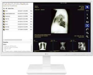 LG 24CK560N 23.8" AIO Healthcare Computer AMD GX-212JJ 4GB 32GB SSD No OS