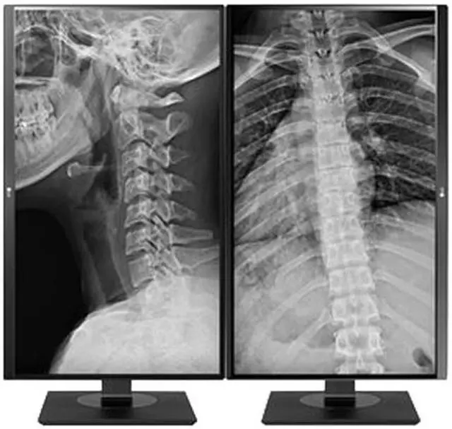 Alt view image 8 of 15 - LG 27HJ713C-B 27" 3840x2160 4K UHD IPS 60 Hz 5ms DICOM 14 8MP Clinical Review Monitor