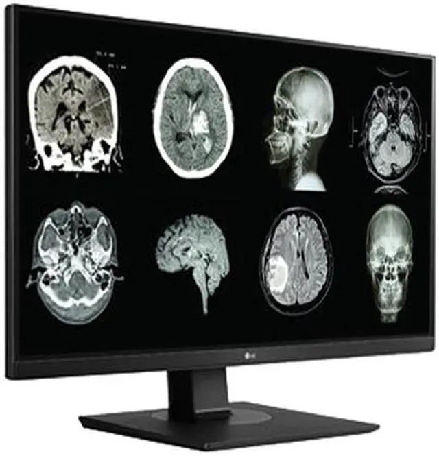 Alt view image 4 of 15 - LG 27HJ713C-B 27" 3840x2160 4K UHD IPS 60 Hz 5ms DICOM 14 8MP Clinical Review Monitor