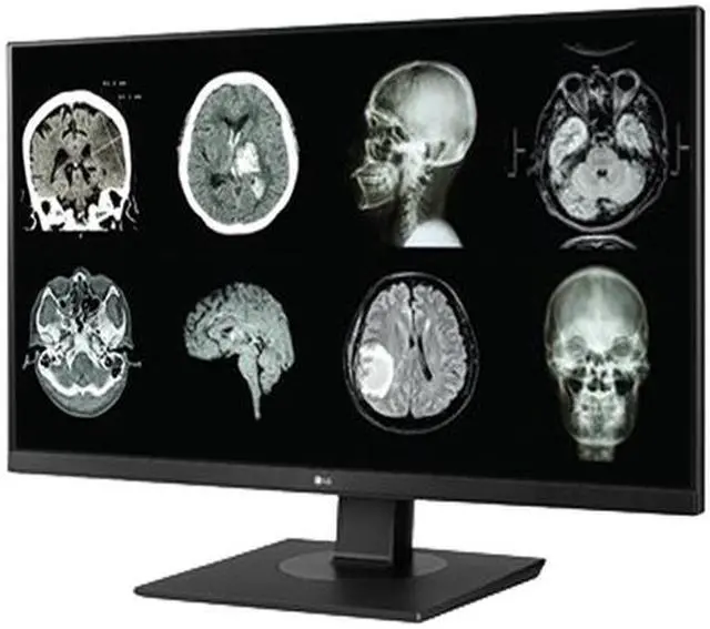 Alt view image 3 of 15 - LG 27HJ713C-B 27" 3840x2160 4K UHD IPS 60 Hz 5ms DICOM 14 8MP Clinical Review Monitor