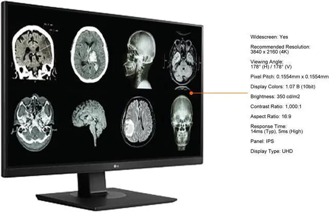 Alt view image 5 of 15 - LG 27HJ713C-B 27" 3840x2160 4K UHD IPS 60 Hz 5ms DICOM 14 8MP Clinical Review Monitor