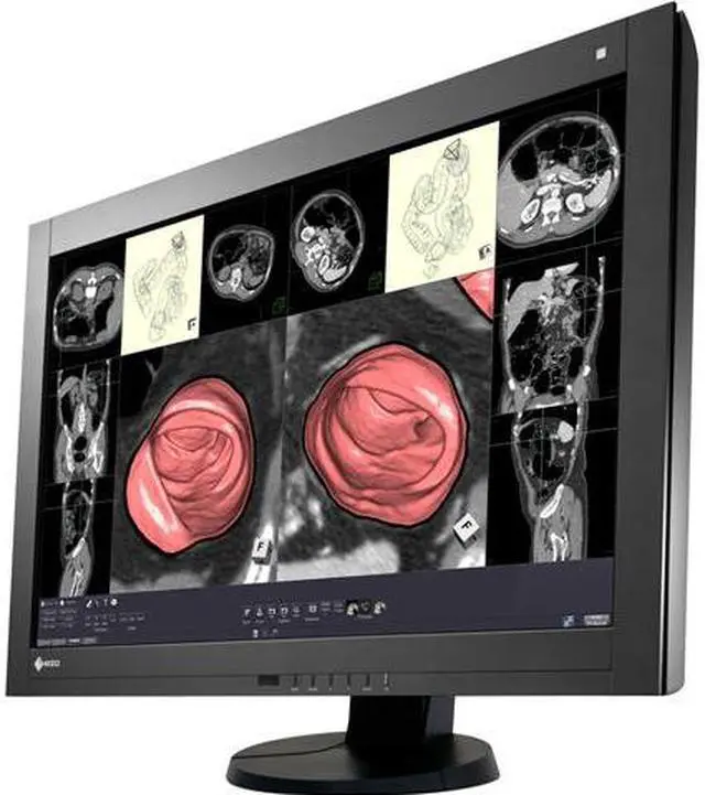 Main image of Eizo RadiForce RX430 29.8' LCD Monitor - 16:10 - 20 ms
