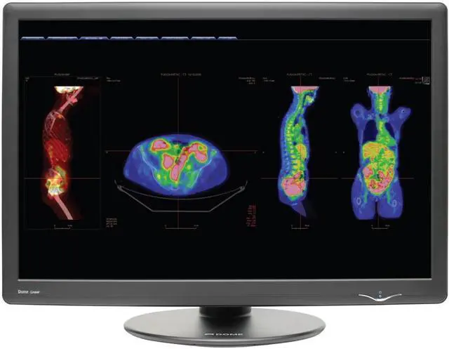Main image of NDS Surgical Imaging Dome GX4MP 30" LCD Monitor - 12 ms