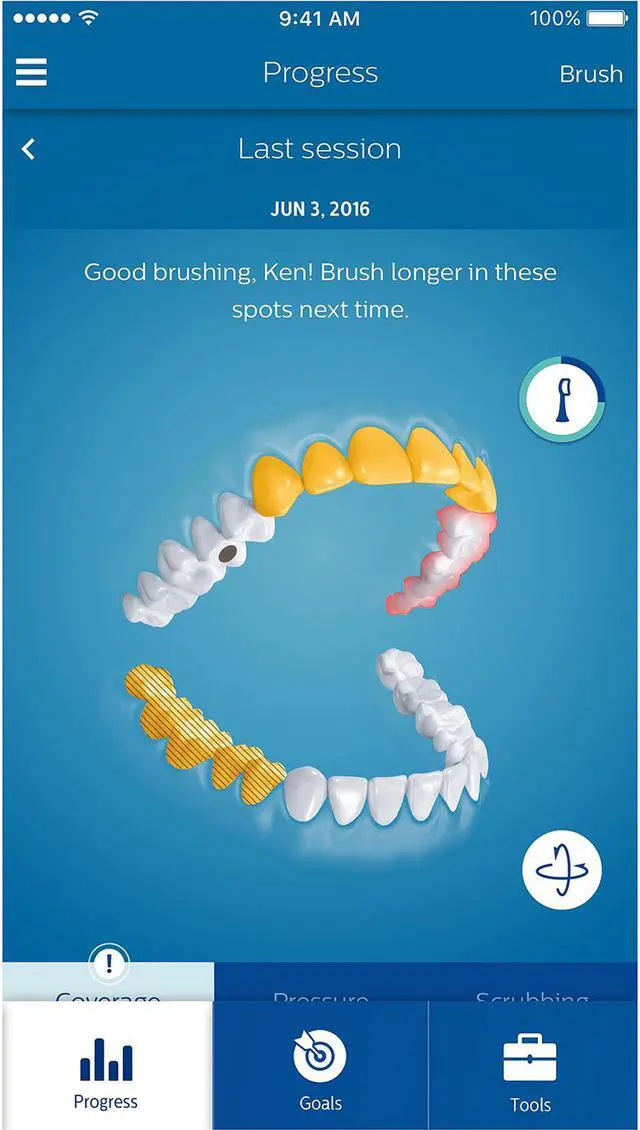 Alt view image 15 of 15 - Philips Sonicare HX9924/11 DiamondClean Smart -  9500 Series - Sonic Electric Toothbrush with Bluetooth and App - Black