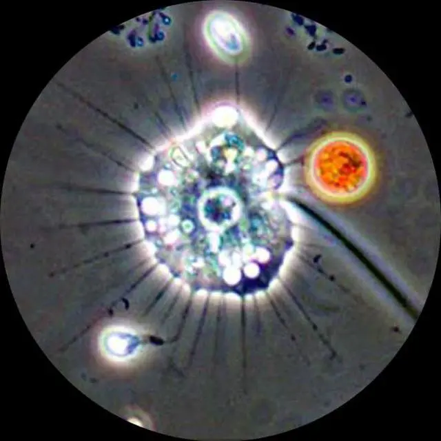 Alt view image 5 of 5 - 40X-1600X Lab Clinic Vet Trinocular Turret Phase Contrast Microscope