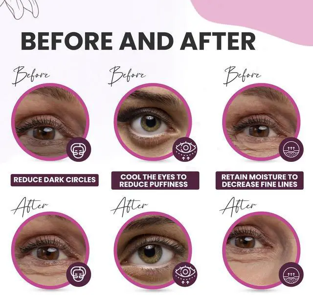 Alt view image 5 of 7 - Collagen Under Eye Patches for Dark Circles, Puffy Eyes & Wrinkles