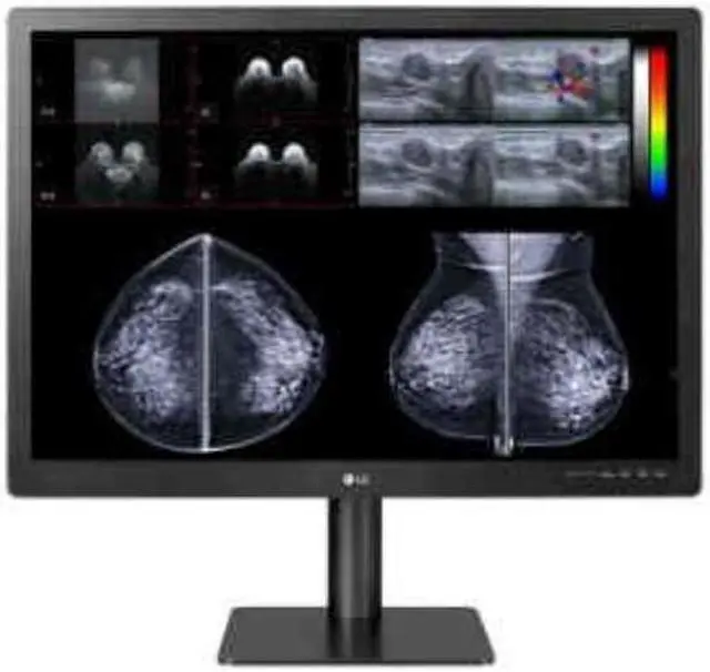 Main image of LG MEDICAL IPS BLACK 8MP DIAGNOSTIC MONITOR WITH FRONT SENSOR 32IN 3840 X 2160 FDA 510K CLASS II - 32HQ713D-B