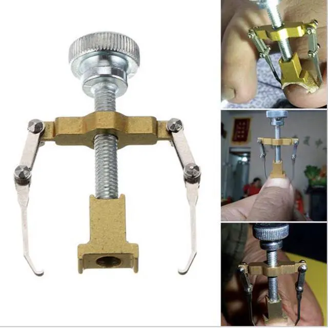 Alt view image 4 of 6 - Ingrown Toenail Correction Tool