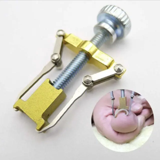 Alt view image 3 of 6 - Ingrown Toenail Correction Tool