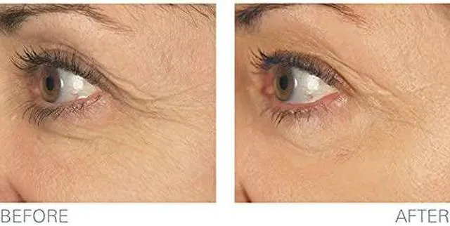 Alt view image 4 of 5 - Stem Cell Therapy by BioLogic Solutions (1 oz.)