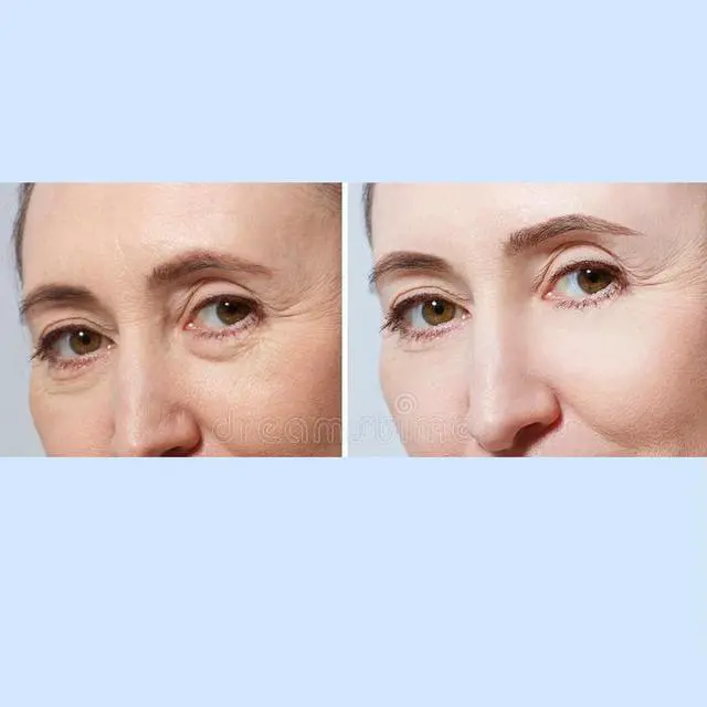 Alt view image 4 of 4 - Genesphere with Acquacell by Biologic Solutions, 1 fl. oz.