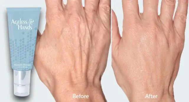 Alt view image 3 of 4 - Ageless Hands Intensive Therapy (2 fl oz)
