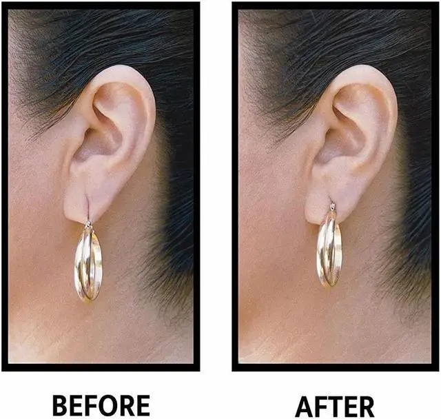 Alt view image 4 of 4 - EarLift Invisible Ear Lobe Support Solution- 180 count