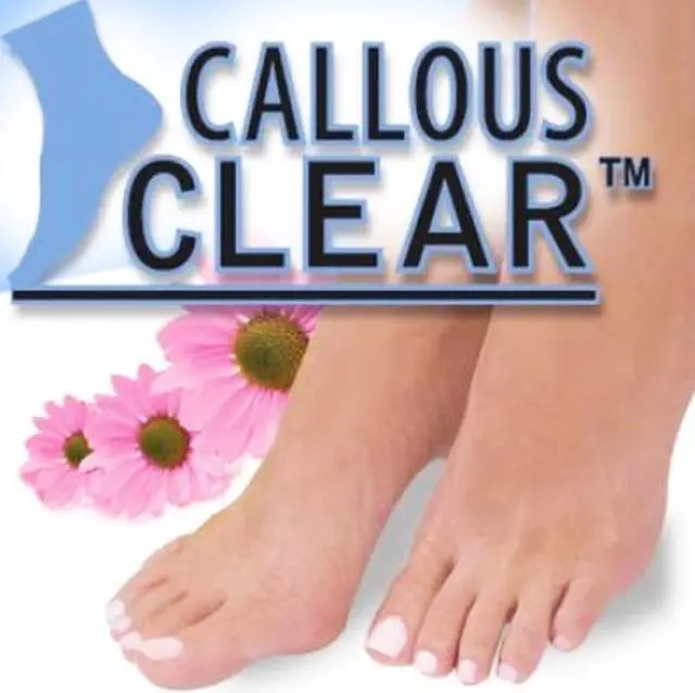 Alt view image 4 of 4 - Callous Clear Foot Treatment Kit Deluxe