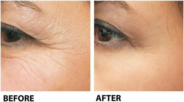 Alt view image 4 of 6 - Stem Cell Therapy by BioLogic Solutions (1 oz.)
