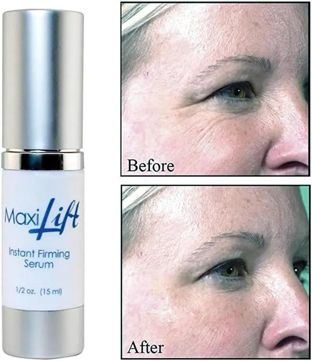 Alt view image 3 of 7 - Maxilift Instant Firming Serum by BioLogic Solutions, 0.5 oz.