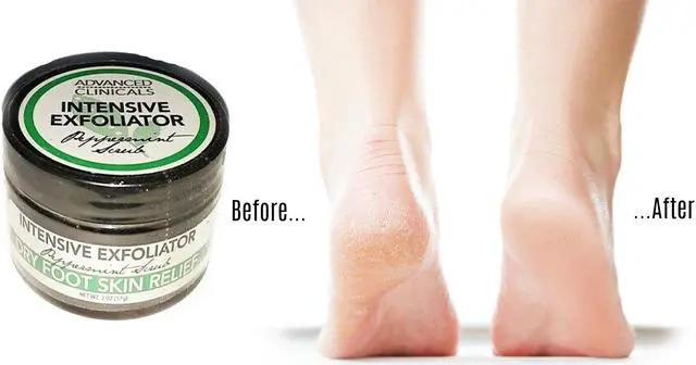 Alt view image 3 of 3 - Advanced Clinicals Intensive Dry Foot Exfoliator Peppermint Scrub- 1 fl. oz