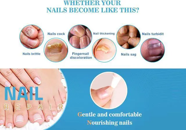 Alt view image 2 of 5 - Lanthome Nail Repair