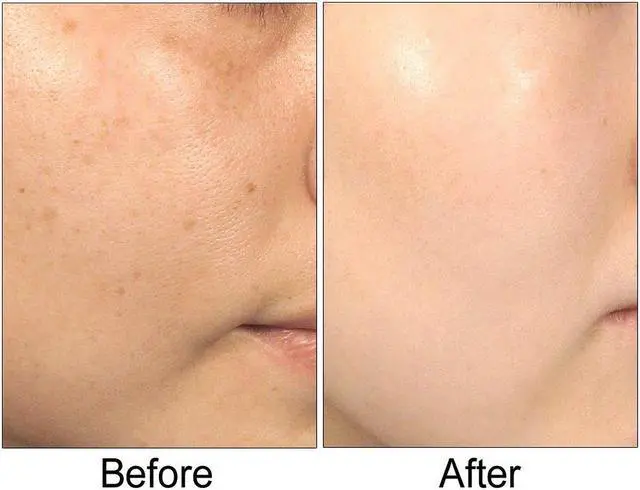 Alt view image 5 of 5 - Lumetrics with Copuline by BioLogic Solutions 1 oz.