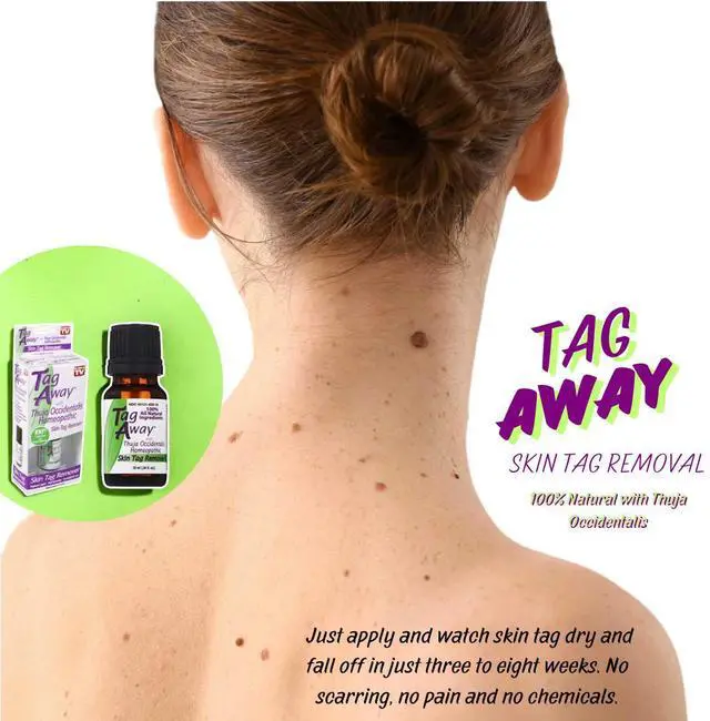 Alt view image 4 of 5 - Nature's Pillows Tag Away Skin Removal - Natural Wart & Skin Tag Treatment