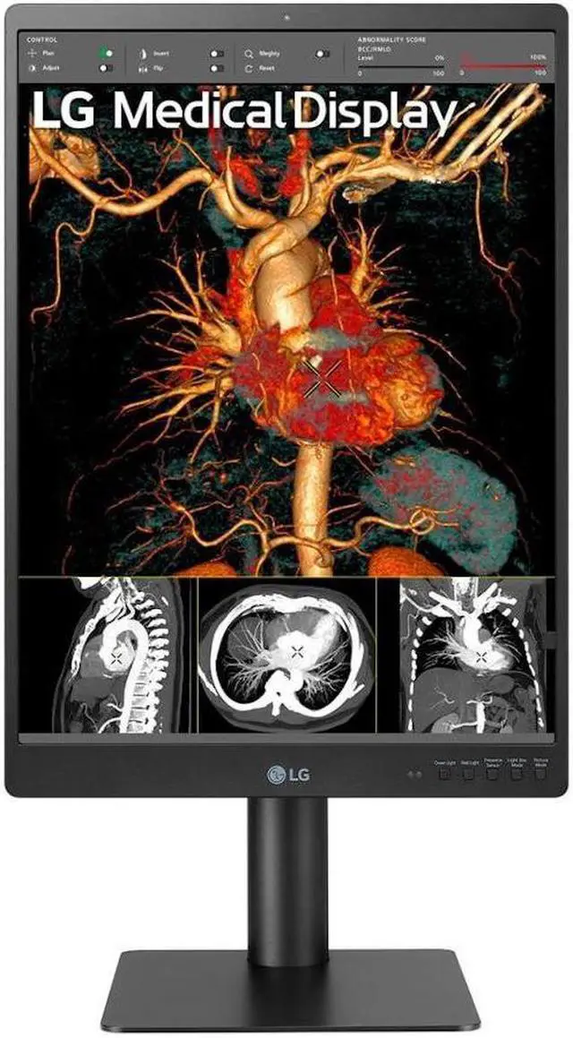 Alt view image 3 of 13 - LG 21HQ513D-B 21.3" QXGA LCD Monitor - 3:4 - 21" Class - In-plane Switching (IPS) Technology - 2048 x 1536 - 1100 Nit - 5 ms - DVI - DisplayPort