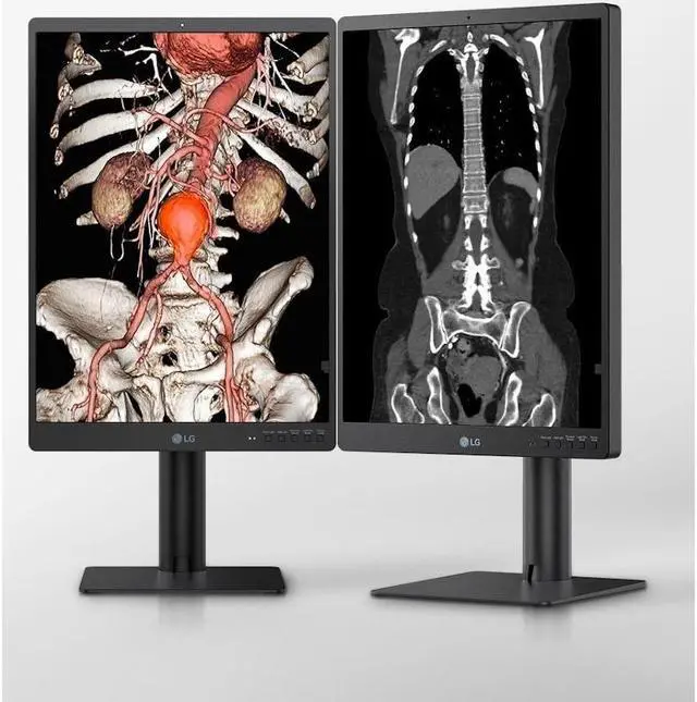 Alt view image 7 of 13 - LG 21HQ513D-B 21.3" QXGA LCD Monitor - 3:4 - 21" Class - In-plane Switching (IPS) Technology - 2048 x 1536 - 1100 Nit - 5 ms - DVI - DisplayPort