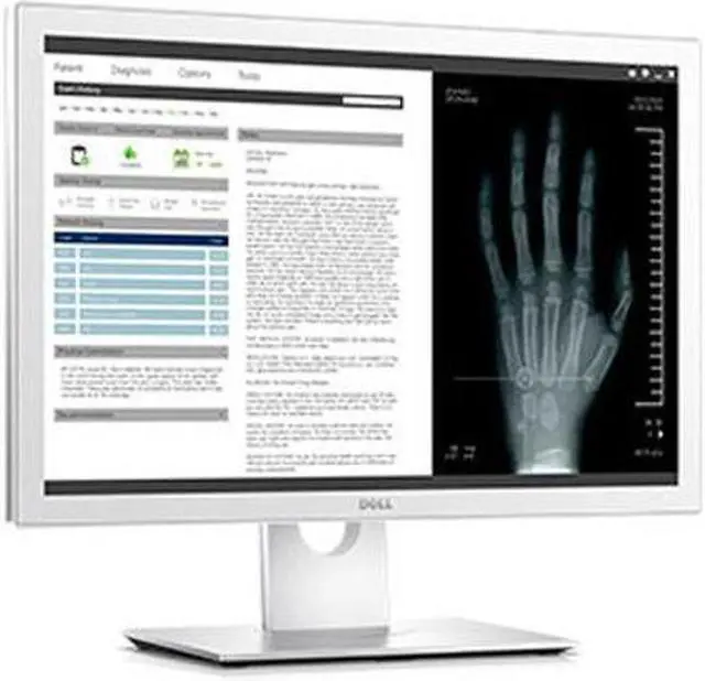 Alt view image 7 of 16 - Dell Medical Review MR2416 White 24" 60HZ IPS 1920 x 1200 LED LCD Monitor with VESA Mount Compatibility, Swivel&Tilt&Height&Pivot Adjustable, 1000: 1 300 cd/m2,  HDMI/DP/VGA/USB
