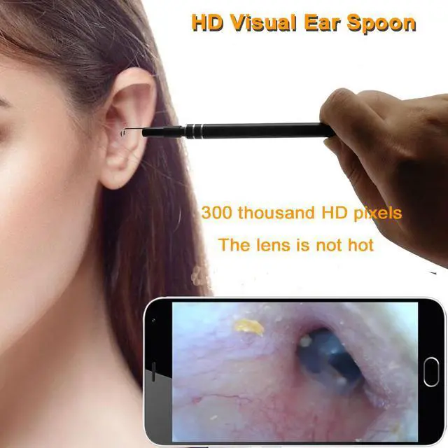Alt view image 2 of 6 - 2 in 1 USB Port Ear Nose camera Endoscope 5.5mm Visual Lens Mini Borescope Earpick Otoscope Endoscope for PC Windows