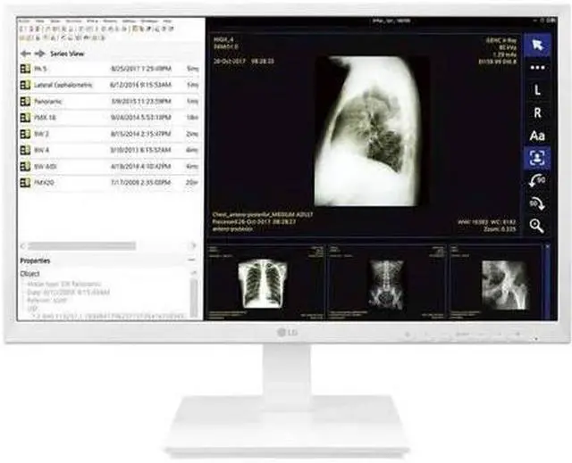 Alt view image 18 of 20 - LG 24CK560N 23.8" AIO Healthcare Computer AMD GX-212JJ 4GB 32GB SSD No OS