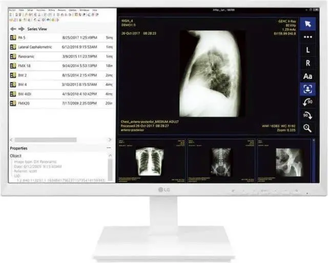 Alt view image 14 of 20 - LG 24CK560N 23.8" AIO Healthcare Computer AMD GX-212JJ 4GB 32GB SSD No OS
