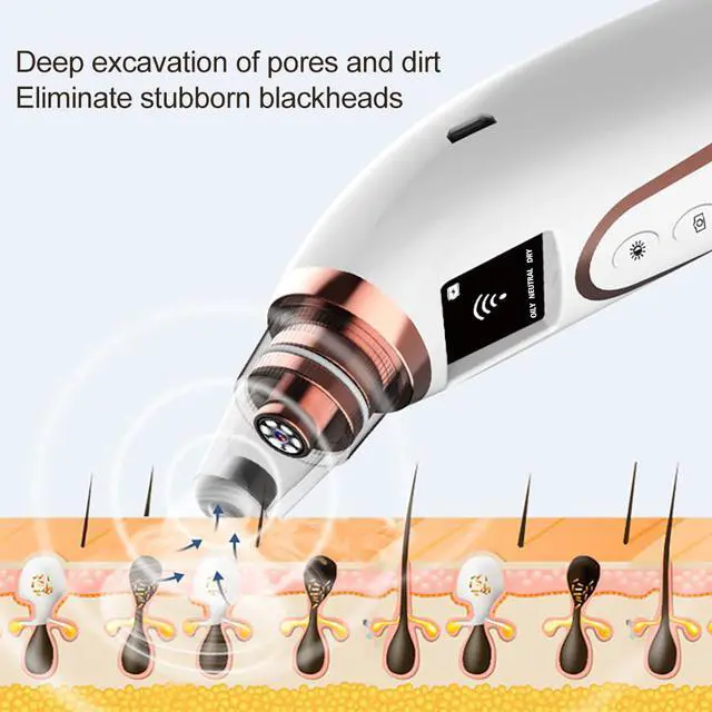 Alt view image 5 of 7 - Smart wireless WiFi Strong suction visual blackhead meter supports Android / IOS