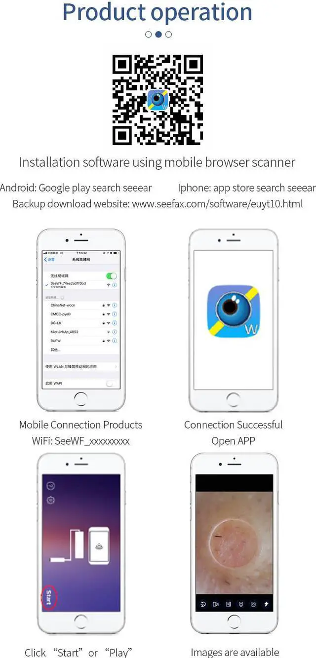Alt view image 6 of 7 - Smart wireless WiFi Strong suction visual blackhead meter supports Android / IOS