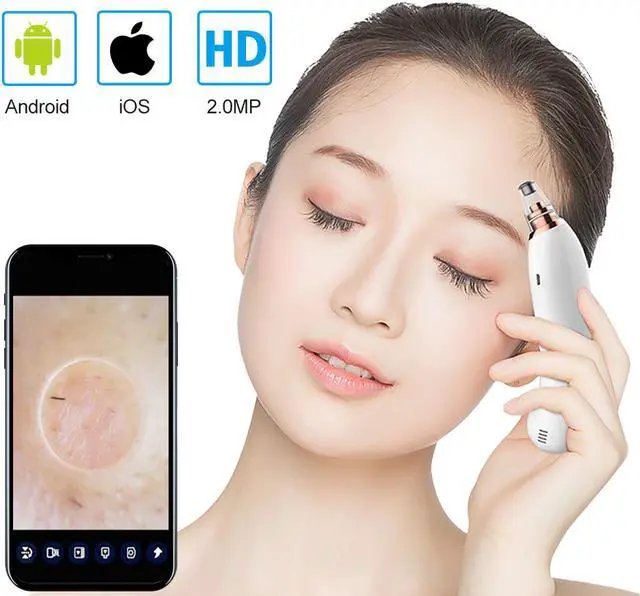 Main image of Smart wireless WiFi Strong suction visual blackhead meter supports Android / IOS