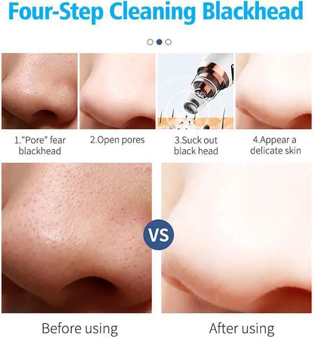 Alt view image 4 of 7 - Smart wireless WiFi Strong suction visual blackhead meter supports Android / IOS