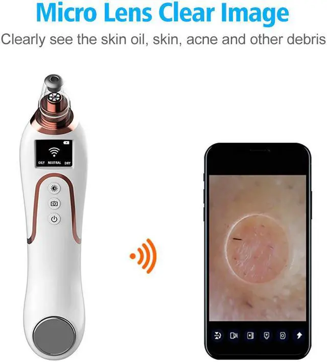 Alt view image 2 of 7 - Smart wireless WiFi Strong suction visual blackhead meter supports Android / IOS