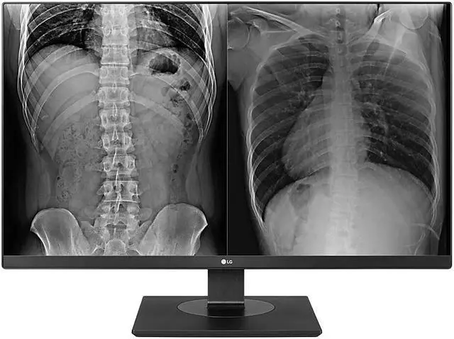 Alt view image 7 of 15 - LG 27HJ713C-B 27" 3840x2160 4K UHD IPS 60 Hz 5ms DICOM 14 8MP Clinical Review Monitor