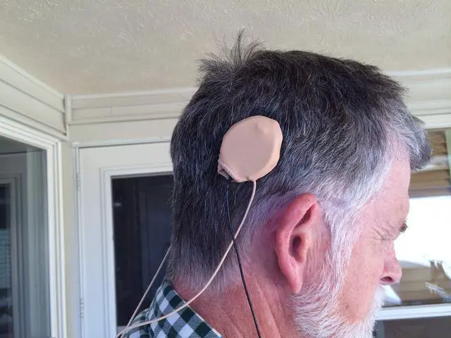 Alt view image 6 of 6 - Ear Gear Rondo Mono Protect Implants from Dirt, Sweat, Moisture, Loss, Wind Fits Most Medel Rondo Processors