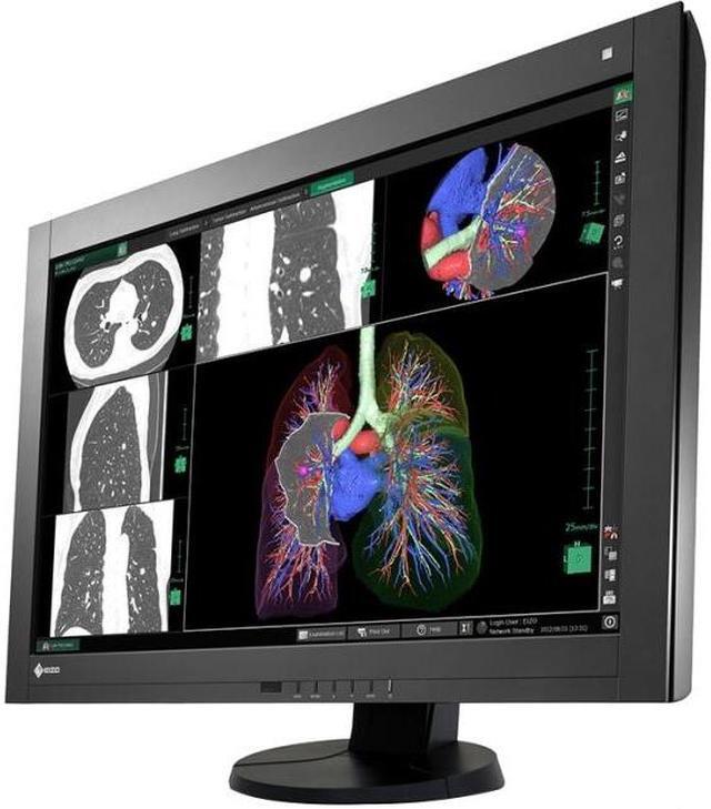 【レビューで送料無料】 Eizo RadiForce RX440 29.8 ディスプレイ・モニター本体