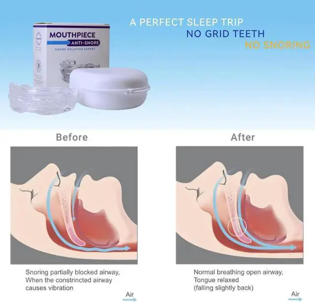 Alt view image 3 of 6 - Anti Snoring Device, Men/Women Mouth Guard Sleep Apnea Dental Lab Approved Stop snoring(3pcs)