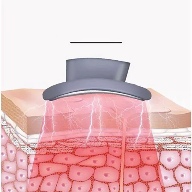 Alt view image 3 of 7 - Intelligent Neck Massage Instrument Portable Neck Massage an