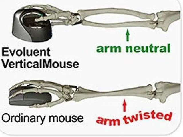 Alt view image 2 of 2 - Evoluent 4 Right Wireless Vertical Mouse (VM4RW)