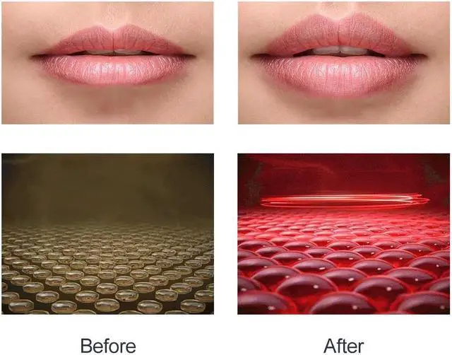 Main image of Lip Pump Fuller Electric Lip Plumper LED Light Therapy Enhancer Sexy Thicker Lips Plumping Tool Mouth Enhancer Bigger Thicker