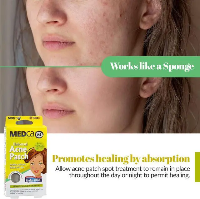 Alt view image 4 of 7 - MEDca Acne Pimple Master Patch Absorbing Cover 24 Count Three Sizes 10 Sheets