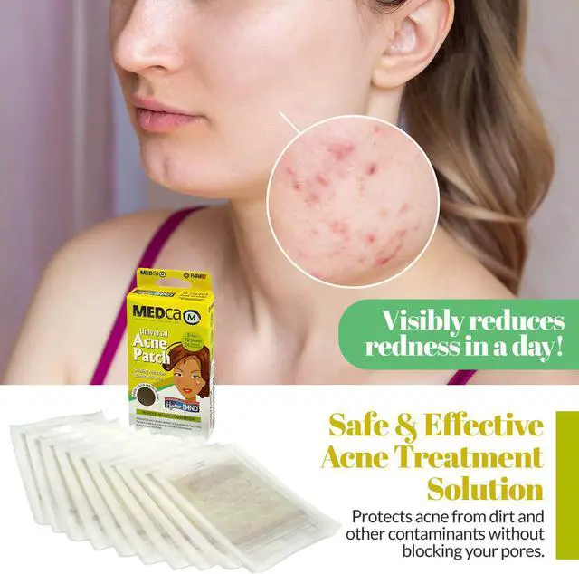 Alt view image 3 of 7 - MEDca Acne Pimple Master Patch Absorbing Cover 24 Count Three Sizes 10 Sheets