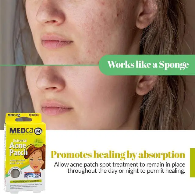 Alt view image 4 of 7 - MEDca Acne Pimple Master Patch Absorbing Cover 24 Count Three Sizes 10 Sheets