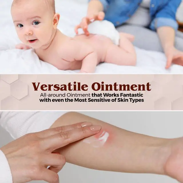 Alt view image 6 of 7 - MEDca Vitamin A & D Diaper Rash Ointment- Protectant Cream For Sensitive Baby Skin - Lanolin & Petrolatum Formula, Dry-Cracked Hands/Feet/Face Skin, 1oz Tube, Bulk Case of 72