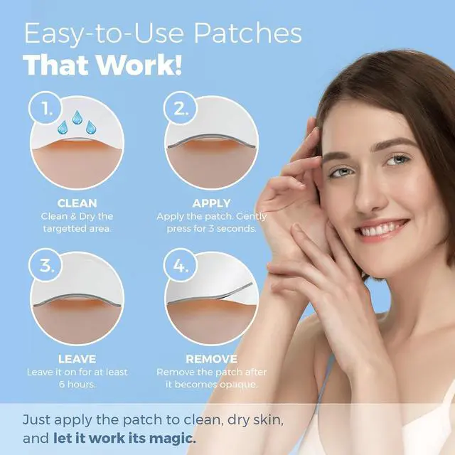 Alt view image 4 of 7 - MEDca Acne Pimple Master Patch Absorbing Cover 24 Count Three Sizes 10 Sheets